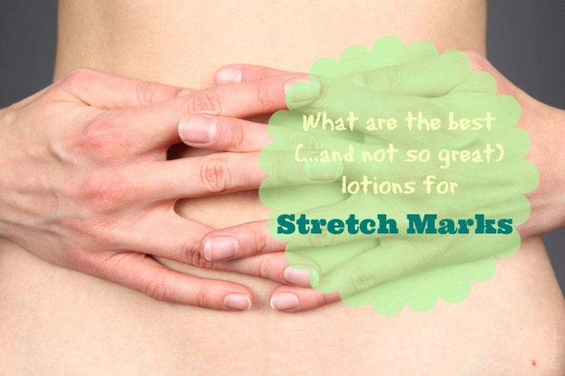 best-lotion-for-stretch-marks